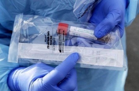 Azərbaycanda daha 21 nəfər koronavirusdan öldü: 633 yeni yoluxma - FOTO