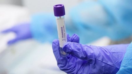 Azərbaycanda daha 12 nəfər koronavirusdan öldü: 349 yeni yoluxma - FOTO