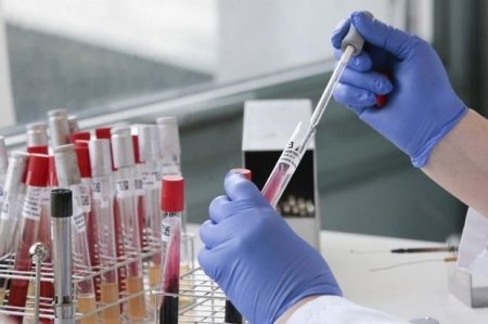 Deputatdan TƏKLİF: Koronavirus testlərinin qiyməti endirilsin