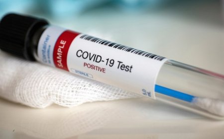 Azərbaycanda koronavirus (COVID-19) infeksiyasına son sutkada 29 yeni yoluxma faktı qeydə alınıb