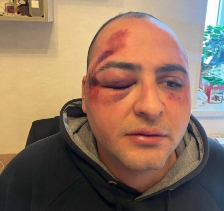 Murad Niftaliyev sosial şəbəkələrdə yazdığı tənqidi yazıya göre 8-ci Polis bölməsində döyülüb
