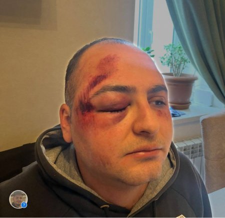 Murad Niftaliyev sosial şəbəkələrdə yazdığı tənqidi yazıya göre 8-ci Polis bölməsində döyülüb