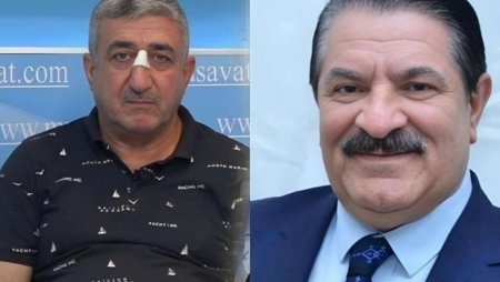 Ağadadaş Ağayevin balta atdığı mühafizəçi həbs edilib