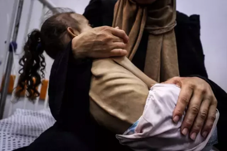Yaşı 9, çəkisi 10 kq olan qəzzalı qızcığaz – FOTOLAR