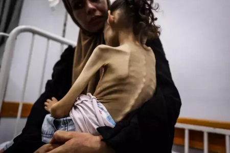 9-jähriges Mädchen aus Gaza wiegt nur noch 10 kg – FOTOS