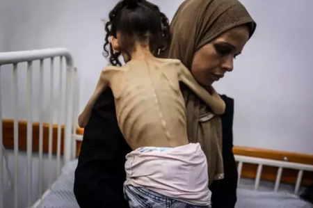  9-jähriges Mädchen aus Gaza wiegt nur noch 10 kg – FOTOS