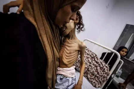  9-jähriges Mädchen aus Gaza wiegt nur noch 10 kg – FOTOS