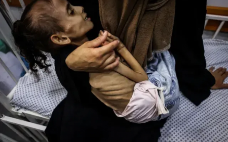  9-jähriges Mädchen aus Gaza wiegt nur noch 10 kg – FOTOS